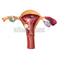 Modelo Anatómico De Ovario De Utero Con Patologías